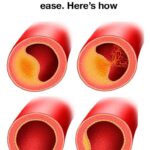 Aluminum foil in the freezer, why you should do it: you save money