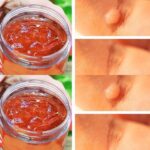 Cinnamon and Honey: The Most Potent Natural Antibiotic That Even Doctors Can’t Fully Explain