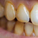 Cook’s Smart Trick for Easily Peeling Hard-Boiled Eggs