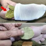 Homemade mosquito trap, the only natural remedy that eliminates them all