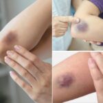 The Vegetable That Eats All The Sugar In The Body.